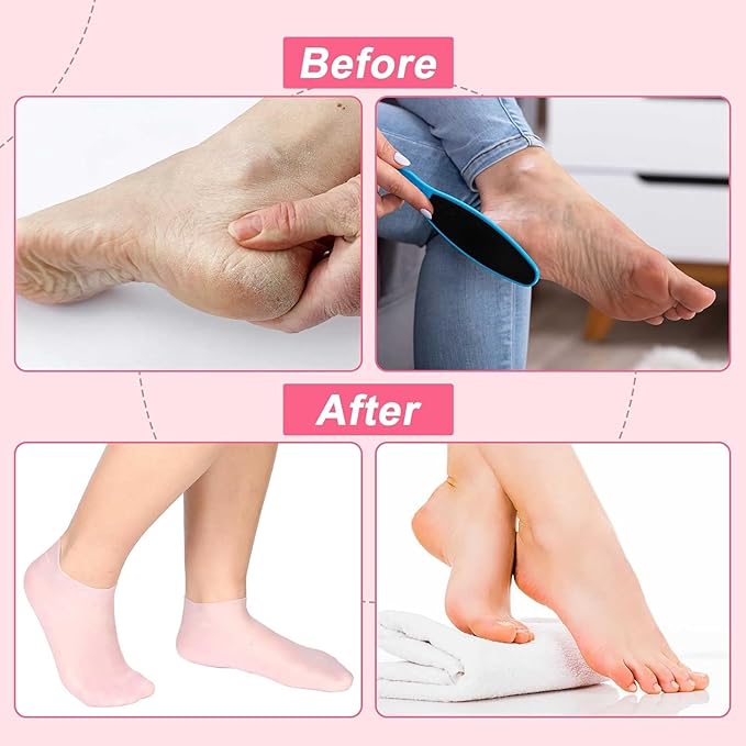 Multicoloured Natural Oil Spa Gel Socks (Pack of 2)