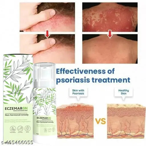 Eczemaron for Ringworm, Itching, Eczema & Fungal Infection Antifungal Cream  (Pack of 1)